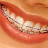 Эстетическая стоматология – путь к прекрасной улыбке!